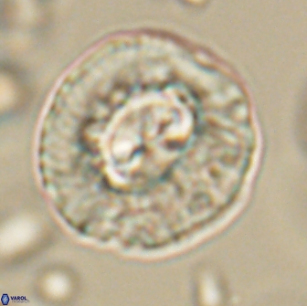 Coccolithus megasarsiae 64786