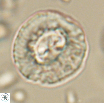 Coccolithus megasarsiae 64786