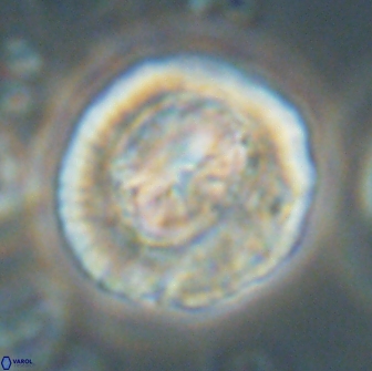 Coccolithus megasarsiae 64788