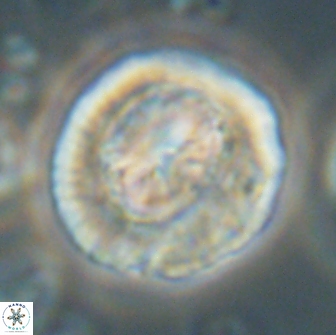 Coccolithus megasarsiae 64788