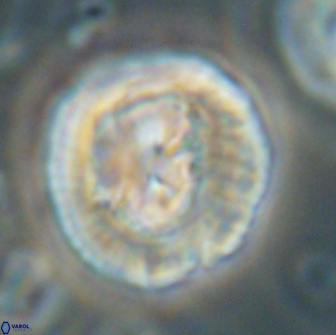 Coccolithus megasarsiae 64789