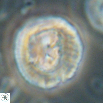 Coccolithus megasarsiae 64789