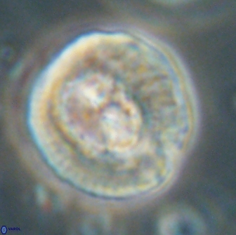 Coccolithus megasarsiae 64790