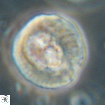 Coccolithus megasarsiae 64790