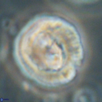 Coccolithus megasarsiae 64791
