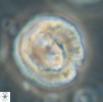 Coccolithus megasarsiae 64791
