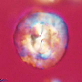 Coccolithus megasarsiae 64793