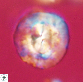 Coccolithus megasarsiae 64793