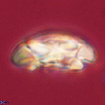 Coccolithus megasarsiae 68251