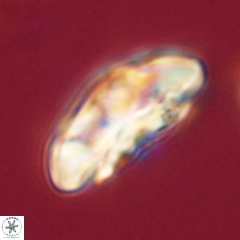 Coccolithus megasarsiae 68253