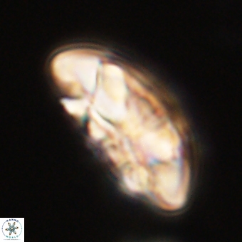 Coccolithus megasarsiae 68255