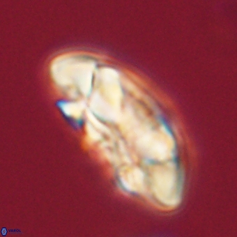 Coccolithus megasarsiae 68256