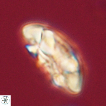 Coccolithus megasarsiae 68256