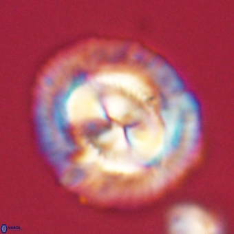 Coccolithus megasarsiae 68261