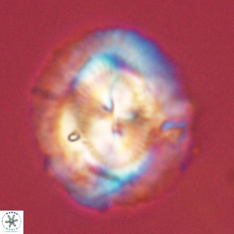 Coccolithus megasarsiae 68273