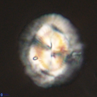 Coccolithus megasarsiae 68274