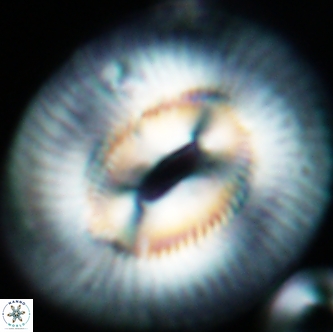 Coccolithus miopelagicus 1473a