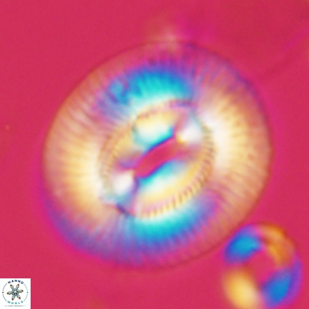 Coccolithus miopelagicus 1472