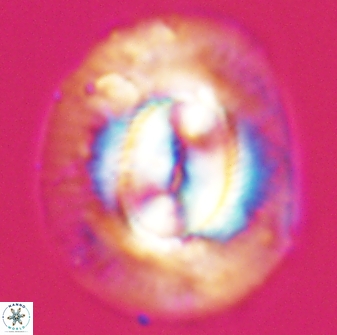 Coccolithus miopelagicus 22769