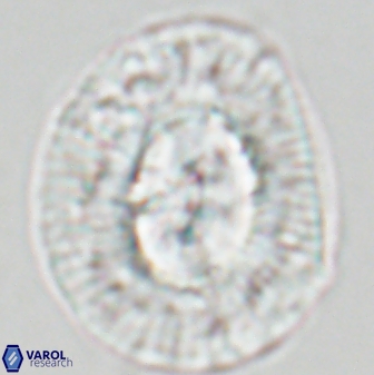 Coccolithus miopelagicus 22773