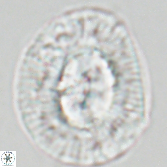 Coccolithus miopelagicus 22773