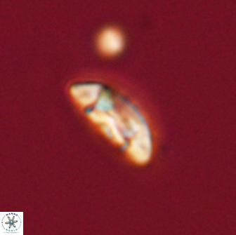 Coccolithus muiri 64093