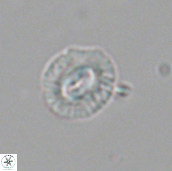 Coccolithus muiri 64105