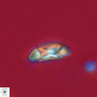 Coccolithus muiri 64111