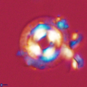 Coccolithus occidentalis 68818