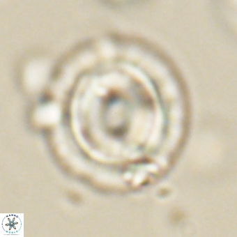Coccolithus occidentalis 68837