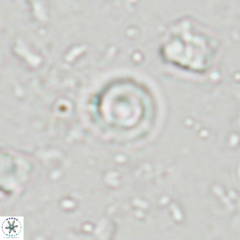 Coccolithus pauxillus 43216