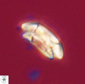 Coccolithus pelagicus VR 33246