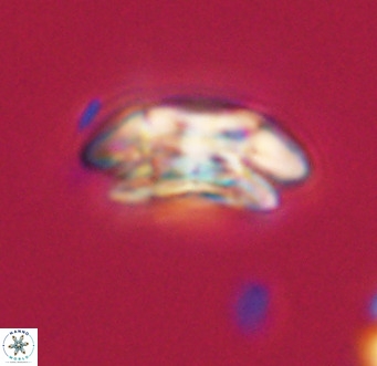 Coccolithus pelagicus VR 33251