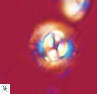 Coccolithus pelagicus VR 33252