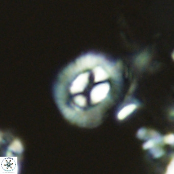 Coccolithus sarsiae VR 04434