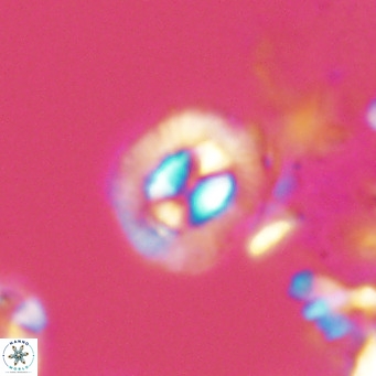 Coccolithus sarsiae VR 04435