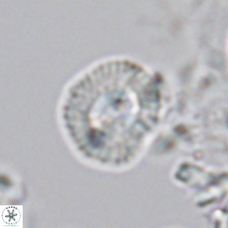 Coccolithus sarsiae VR 04437