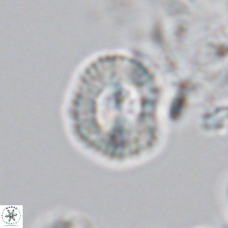 Coccolithus sarsiae VR 04438
