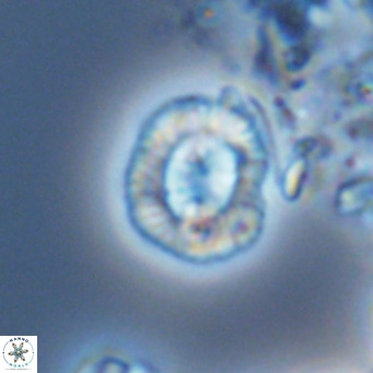 Coccolithus sarsiae VR 04439