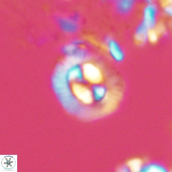 Coccolithus sarsiae VR 04431