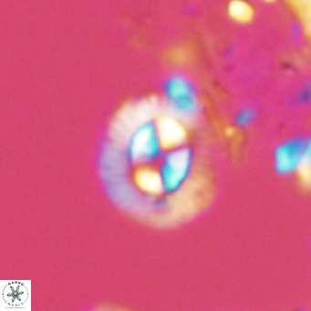 Coccolithus sarsiae VR 04432