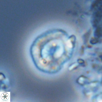 Coccolithus sarsiae VR 04440