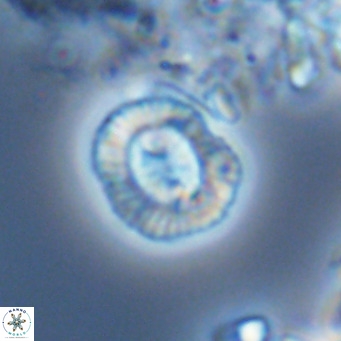 Coccolithus sarsiae VR 04441