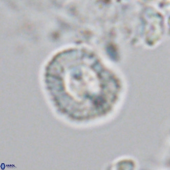 Coccolithus sarsiae VR 04443