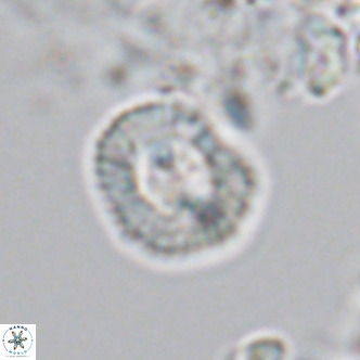 Coccolithus sarsiae VR 04443