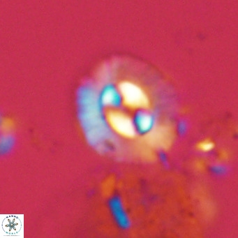 Coccolithus sarsiae VR 05687
