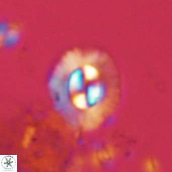 Coccolithus sarsiae VR 05688