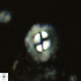 Coccolithus sarsiae VR 05689