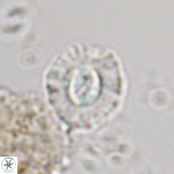 Coccolithus sarsiae VR 05694