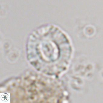 Coccolithus sarsiae VR 05695
